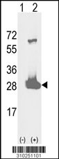 Western blot analysis of his-tag GSTZ1 (arrow) using his tag antibody. 293 cell lysates (2 ug/lane) either nontransfected (Lane 1) or transiently transfected with the GSTZ1 gene (Lane 2, Cat. #LY10251a).