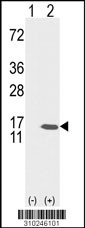 Western blot analysis of his-tag DBI (arrow) using his tag antibody. 293 cell lysates (2 ug/lane) either nontransfected (Lane 1) or transiently transfected with the DBI gene (Lane 2, Cat. #LY10246a).