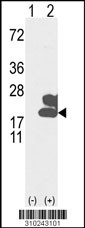Western blot analysis of his-tag CRH (arrow) using his tag antibody. 293 cell lysates (2 ug/lane) either nontransfected (Lane 1) or transiently transfected with the CRH gene (Lane 2, Cat. #LY10243a).