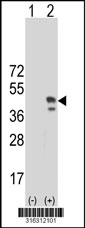 Western blot analysis of his-tag C20orf103 (arrow) using his tag antibody. 293T cell lysates (2 ug/lane) either nontransfected (Lane 1) or transiently transfected with the C20orf103 gene‘