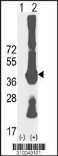 Western blot analysis of his-tag BSG (arrow) using his tag antibody. 293 cell lysates (2 ug/lane) either nontransfected (Lane 1) or transiently transfected with the BSG gene (Lane 2, Cat. #LY10240a).