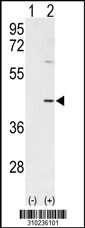 Western blot analysis of his-tag ADH4 (arrow) using his tag antibody. 293 cell lysates (2 ug/lane) either nontransfected (Lane 1) or transiently transfected with the ADH4 gene