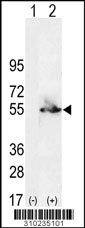 Western blot analysis of his-tag ADH1C (arrow) using his tag antibody. 293 cell lysates (2 ug/lane) either nontransfected (Lane 1) or transiently transfected with the ADH1C gene