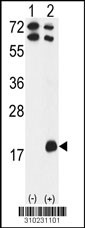 Western blot analysis of his-tag IL2 (arrow) using his tag antibody. 293 cell lysates (2 ug/lane) either nontransfected (Lane 1) or transiently transfected with the IL2 gene (Lane 2, Cat. #LY10231a).