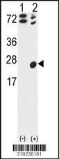 Western blot analysis of his-tag IL23A (arrow) using his tag antibody. 293 cell lysates (2 ug/lane) either nontransfected (Lane 1) or transiently transfected with the IL23A gene (Lane 2, Cat. #LY10230a).
