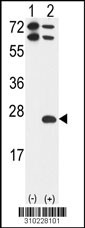 Western blot analysis of his-tag NRBP1 (arrow) using his tag antibody. 293 cell lysates (2 ug/lane) either nontransfected (Lane 1) or transiently transfected with the NRBP1 gene (Lane 2, Cat. #LY10228a).