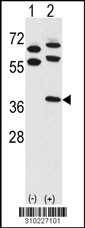 Western blot analysis of his-tag RPLP0 (arrow) using his tag antibody. 293 cell lysates (2 ug/lane) either nontransfected (Lane 1) or transiently transfected with the RPLP0 gene (Lane 2, Cat. #LY10227a).