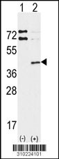 Western blot analysis of his-tag HUS1 (arrow) using his tag antibody. 293 cell lysates (2 ug/lane) either nontransfected (Lane 1) or transiently transfected with the HUS1 gene (Lane 2, Cat. #LY10224a).