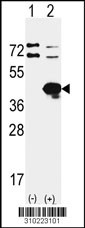 Western blot analysis of his-tag GAPDH (arrow) using his tag antibody. 293 cell lysates (2 ug/lane) either nontransfected (Lane 1) or transiently transfected with the GAPDH gene (Lane 2, Cat. #LY10223a).