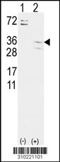 Western blot analysis of his-tag CBX2 (arrow) using his tag antibody. 293 cell lysates (2 ug/lane) either nontransfected (Lane 1) or transiently transfected with the CBX2 gene (Lane 2, Cat. #LY10221a).