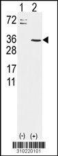 Western blot analysis of his-tag CERK (arrow) using his tag antibody. 293 cell lysates (2 ug/lane) either nontransfected (Lane 1) or transiently transfected with the CERK gene (Lane 2, Cat. #LY10220a).
