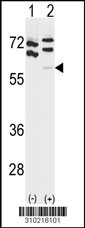 Western blot analysis of his-tag PSMC5 (arrow) using his tag antibody. 293 cell lysates (2 ug/lane) either nontransfected (Lane 1) or transiently transfected with the PSMC5 gene (Lane 2, Cat. #LY10218a).