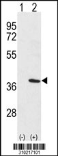Western blot analysis of his-tag PCM1 (arrow) using his tag antibody. 293 cell lysates (2 ug/lane) either nontransfected (Lane 1) or transiently transfected with the PCM1 gene