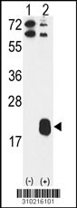 Western blot analysis of his-tag NME3 (arrow) using his tag antibody. 293 cell lysates (2 ug/lane) either nontransfected (Lane 1) or transiently transfected with the NME3 gene (Lane 2, Cat. #LY10216a).