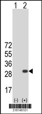 Western blot analysis of his-tag C1orf93 (arrow) using his tag antibody. 293T cell lysates (2 ug/lane) either nontransfected (Lane 1) or transiently transfected with the C1orf93 gene‘