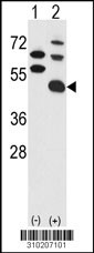 Western blot analysis of his-tag ETNK1 (arrow) using his tag antibody. 293 cell lysates (2 ug/lane) either nontransfected (Lane 1) or transiently transfected with the ETNK1 gene (Lane 2, Cat. #LY10207a).