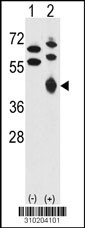 Western blot analysis of his-tag WIF1 (arrow) using his tag antibody. 293 cell lysates (2 ug/lane) either nontransfected (Lane 1) or transiently transfected with the WIF1 gene (Lane 2, Cat. #LY10204a).