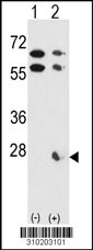 Western blot analysis of his-tag PSMB1 (arrow) using his tag antibody. 293 cell lysates (2 ug/lane) either nontransfected (Lane 1) or transiently transfected with the PSMB1 gene (Lane 2, Cat. #LY10203a).