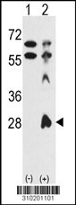 Western blot analysis of his-tag PSMA7 (arrow) using his tag antibody. 293 cell lysates (2 ug/lane) either nontransfected (Lane 1) or transiently transfected with the PSMA7 gene (Lane 2, Cat. #LY10201a).