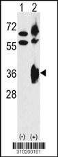 Western blot analysis of his-tag TNFSF15 (arrow) using his tag antibody. 293 cell lysates (2 ug/lane) either nontransfected (Lane 1) or transiently transfected with the TNFSF15 gene (Lane 2, Cat. #LY10200a).