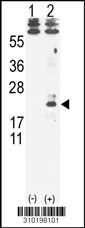 Western blot analysis of his-tag IL5 (arrow) using his tag antibody. 293 cell lysates (2 ug/lane) either nontransfected (Lane 1) or transiently transfected with the IL5 gene (Lane 2, Cat. #LY10198a).