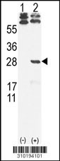 Western blot analysis of his-tag IFNA17 (arrow) using his tag antibody. 293 cell lysates (2 ug/lane) either nontransfected (Lane 1) or transiently transfected with the IFNA17 gene (Lane 2, Cat. #LY10194a).