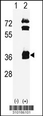 Western blot analysis of his-tag DKK1 (arrow) using his tag antibody. 293 cell lysates (2 ug/lane) either nontransfected (Lane 1) or transiently transfected with the DKK1 gene (Lane 2, Cat. #LY10186a).
