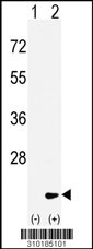 Western blot analysis of his-tag IL10 (arrow) using his tag antibody. 293 cell lysates (2 ug/lane) either nontransfected (Lane 1) or transiently transfected with the IL10 gene (Lane 2, Cat. #LY10185a).