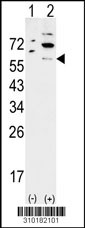 Western blot analysis of his-tag SOCS3 (arrow) using his tag antibody. 293 cell lysates (2 ug/lane) either nontransfected (Lane 1) or transiently transfected with the SOCS3 gene (Lane 2, Cat. #LY10183a).