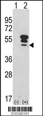 Western blot analysis of his-tag RXRG (arrow) using his tag antibody. 293 cell lysates (2 ug/lane) either nontransfected (Lane 1) or transiently transfected with the RXRG gene (Lane 2, Cat. #LY10180a).