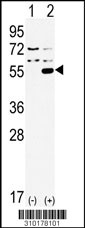 Western blot analysis of his-tag VDR (arrow) using his tag antibody. 293 cell lysates (2 ug/lane) either nontransfected (Lane 1) or transiently transfected with the VDR gene (Lane 2, Cat. #LY10178a).