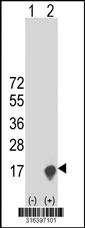 Western blot analysis of his-tag CRCT1 (arrow) using his tag antibody. 293T cell lysates (2 ug/lane) either nontransfected (Lane 1) or transiently transfected with the CRCT1 gene‘