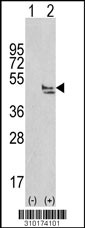 Western blot analysis of his-tag MAPK14 (arrow) using his tag antibody. 293 cell lysates (2 ug/lane) either nontransfected (Lane 1) or transiently transfected with the MAPK14 gene (Lane 2, Cat. #LY10174a).