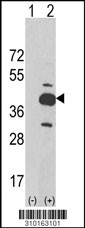 Western blot analysis of his-tag PPP4C (arrow) using his tag antibody. 293 cell lysates (2 ug/lane) either nontransfected (Lane 1) or transiently transfected with the PPP4C gene (Lane 2, Cat. #LY10163a).