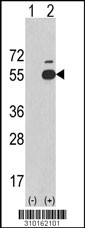 Western blot analysis of his-tag CSNK1D (arrow) using his tag antibody. 293 cell lysates (2 ug/lane) either nontransfected (Lane 1) or transiently transfected with the CSNK1D gene (Lane 2, Cat. #LY10162a).