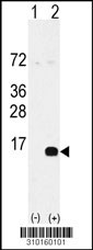 Western blot analysis of his-tag CCL4L2 (arrow) using his tag antibody. 293 cell lysates (2 ug/lane) either nontransfected (Lane 1) or transiently transfected with the CCL4L2 gene (Lane 2, Cat. #LY10160a).