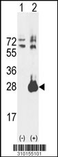 Western blot analysis of his-tag CMPK (arrow) using his tag antibody. 293 cell lysates (2 ug/lane) either nontransfected (Lane 1) or transiently transfected with the CMPK gene (Lane 2, Cat. #LY10155a).