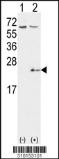 Western blot analysis of his-tag NME6 (arrow) using his tag antibody. 293 cell lysates (2 ug/lane) either nontransfected (Lane 1) or transiently transfected with the NME6 gene (Lane 2, Cat. #LY10153a).