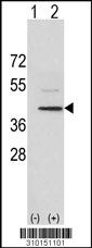 Western blot analysis of his-tag MAPK12 (arrow) using his tag antibody. 293 cell lysates (2 ug/lane) either nontransfected (Lane 1) or transiently transfected with the MAPK12 gene (Lane 2, Cat. #LY10151a).