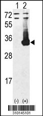 Western blot analysis of his-tag KHK (arrow) using his tag antibody. 293 cell lysates (2 ug/lane) either nontransfected (Lane 1) or transiently transfected with the KHK gene (Lane 2, Cat. #LY10145a).