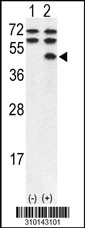 Western blot analysis of his-tag GALK2 (arrow) using his tag antibody. 293 cell lysates (2 ug/lane) either nontransfected (Lane 1) or transiently transfected with the GALK2 gene (Lane 2, Cat. #LY10143a).