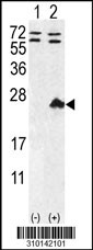 Western blot analysis of his-tag EFNA4 (arrow) using his tag antibody. 293 cell lysates (2 ug/lane) either nontransfected (Lane 1) or transiently transfected with the EFNA4 gene (Lane 2, Cat. #LY10142a).