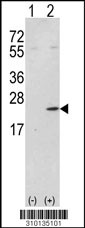Western blot analysis of his-tag CDKN1A (arrow) using his tag antibody. 293 cell lysates (2 ug/lane) either nontransfected (Lane 1) or transiently transfected with the CDKN1A gene (Lane 2, Cat. #LY10135a).
