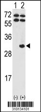 Western blot analysis of his-tag AK2 (arrow) using his tag antibody. 293 cell lysates (2 ug/lane) either nontransfected (Lane 1) or transiently transfected with the AK2 gene (Lane 2, Cat. #LY10134a).