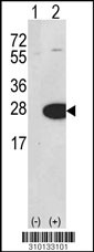 Western blot analysis of his-tag AK1 (arrow) using his tag antibody. 293 cell lysates (2 ug/lane) either nontransfected (Lane 1) or transiently transfected with the AK1 gene (Lane 2, Cat. #LY10133a).