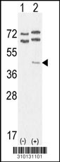 Western blot analysis of his-tag CAPZA2 (arrow) using his tag antibody. 293 cell lysates (2 ug/lane) either nontransfected (Lane 1) or transiently transfected with the CAPZA2 gene (Lane 2, Cat. #LY10131a).