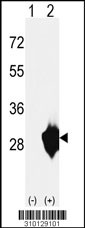 Western blot analysis of his-tag HADH2 (arrow) using his tag antibody. 293 cell lysates (2 ug/lane) either nontransfected (Lane 1) or transiently transfected with the HADH2 gene (Lane 2, Cat. #LY10129a).