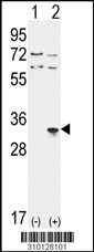 Western blot analysis of his-tag CAPZB (arrow) using his tag antibody. 293 cell lysates (2 ug/lane) either nontransfected (Lane 1) or transiently transfected with the CAPZB gene (Lane 2, Cat. #LY10128a).