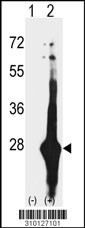 Western blot analysis of his-tag APRT (arrow) using his tag antibody. 293 cell lysates (2 ug/lane) either nontransfected (Lane 1) or transiently transfected with the APRT gene (Lane 2, Cat. #LY10127a).