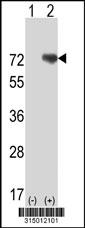 Western blot analysis of his-tag PALMD (arrow) using his tag antibody. 293T cell lysates (2 ug/lane) either nontransfected (Lane 1) or transiently transfected with the PALMD gene‘